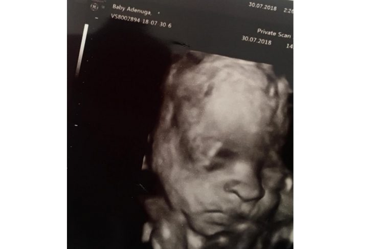 37508078_238372803465847_2620269292846841856_n